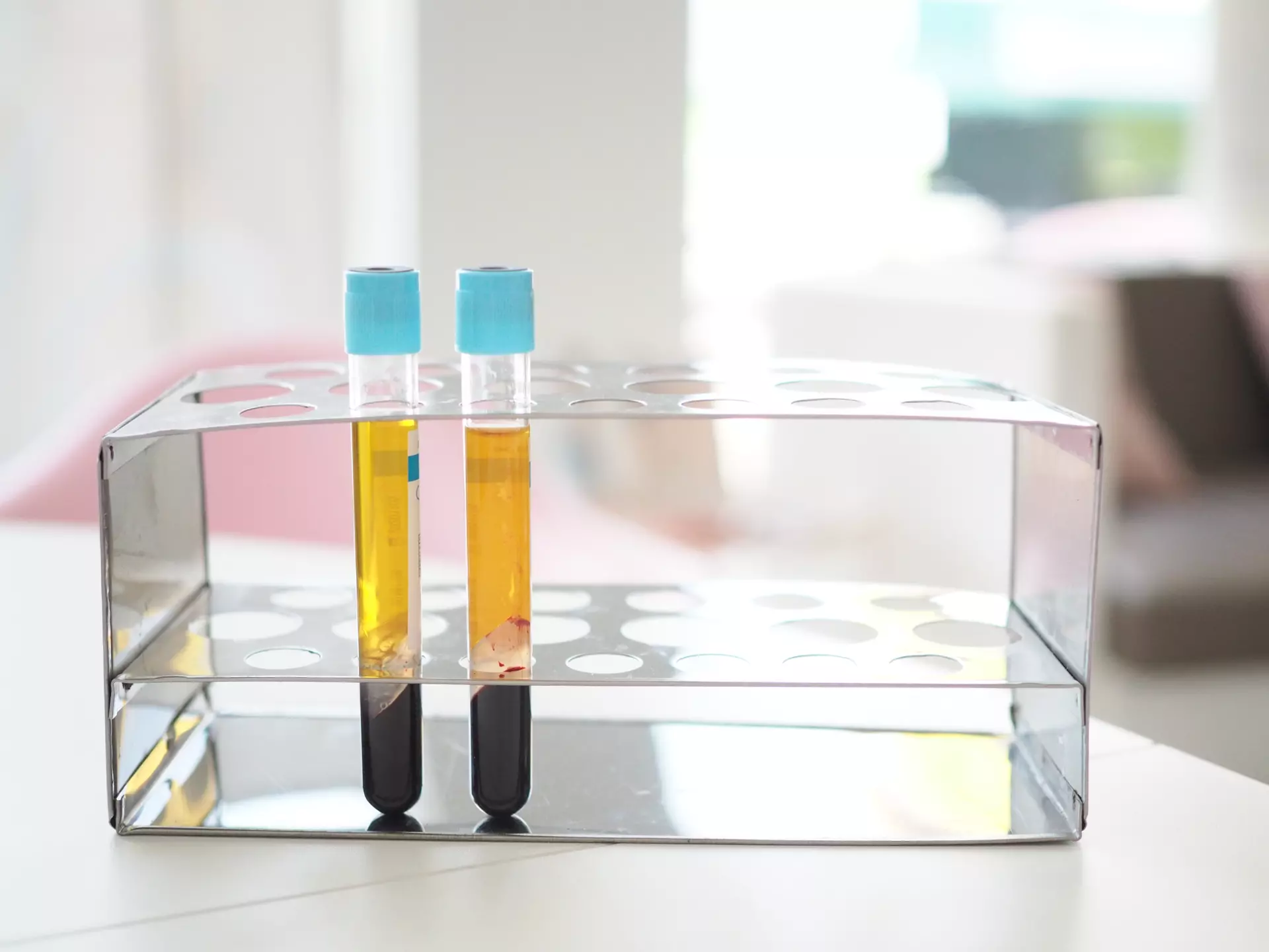 PRP Skin and Hair Restoration in Grapevine | Saba Med Spa